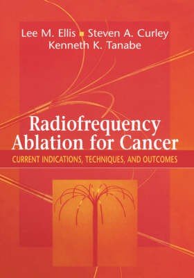 Radiofrequency Ablation for Cancer