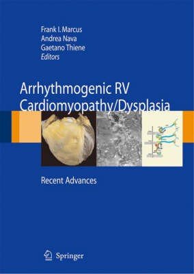 Arrhythmogenicrv Cardiomyopathy / Dysplasia