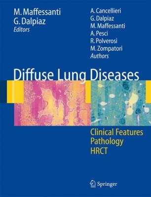 Diffuse Lung Diseases