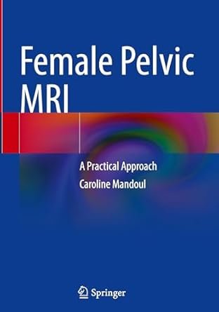 Female Pelvic MRI