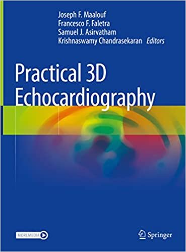 Practical 3D Echocardiography