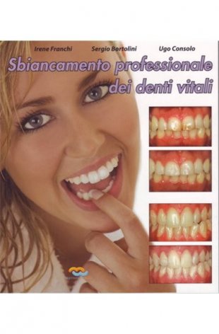 Sbiancamento professionale dei denti vitali