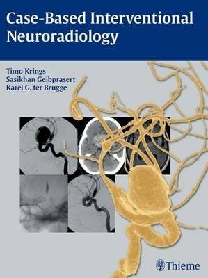 Case-based Interventional Neuroradiology