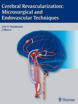 Cerebral Revascularization: Microsurgical and Endovascular Techniques