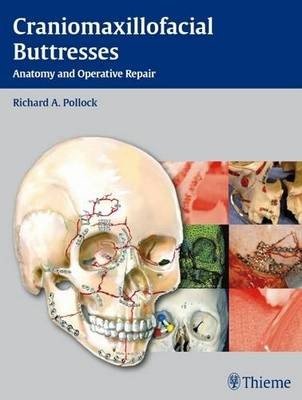 Craniomaxillofacial Buttresses