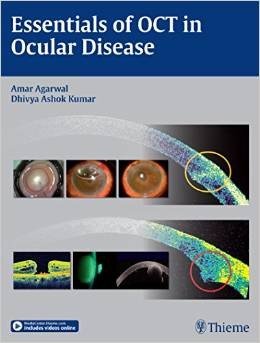 Essentials of Oct in Ocular Disease