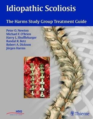 Idiopathic Scoliosis