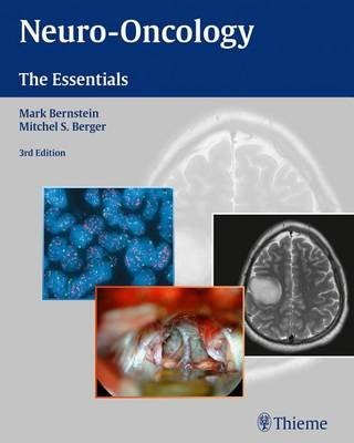 Neuro-Oncology