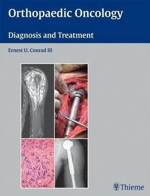 Orthopaedic Oncology
