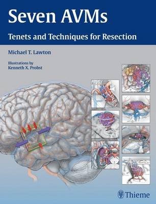 Seven Avms: Tenets and Techniques for Resection