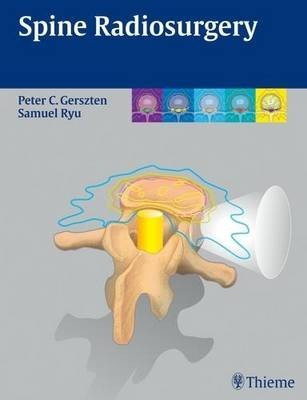 Spine Radiosurgery