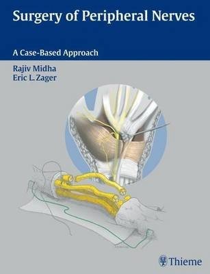 Surgery of Peripheral Nerves