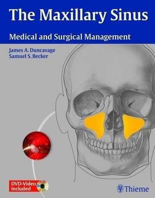 The Maxillary Sinus