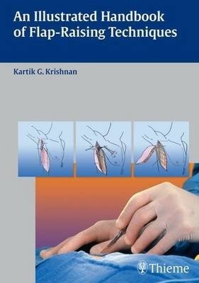 An Illustrated Handbook of Flap-raising Techniques