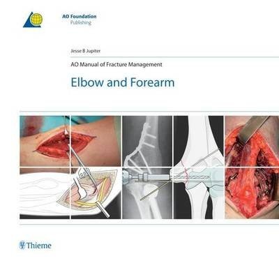 AO Manual of Fracture Management