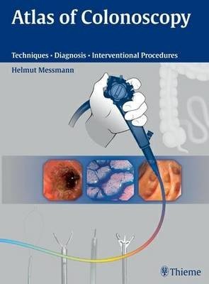 Atlas of Colonoscopy