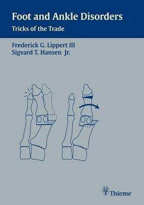 Foot and Ankle Disorders