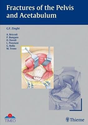Fractures of the Pelvis and Acetabulum