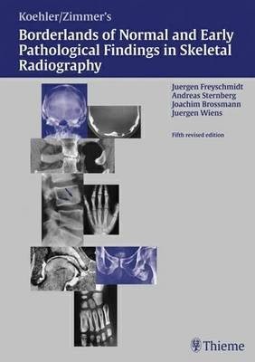 Koehler/Zimmer's Borderlands of Normal and Early Pathological Findings in Skeletal Radiography