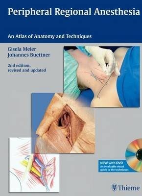 Peripheral Regional Anesthesia