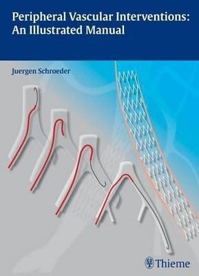 Peripheral Vascular Interventions: An Illustrated Manual
