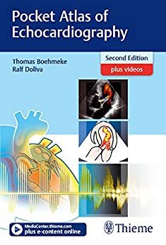 Pocket Atlas of Echocardiography