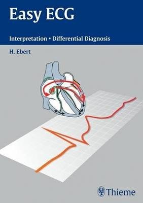 The EKG Guide