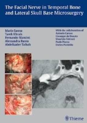 The Facial Nerve in Temporal Bone and Lateral Skull Base