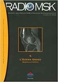 L' edema osseo