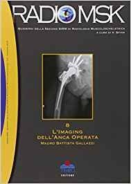 L' imaging dell'anca operata
