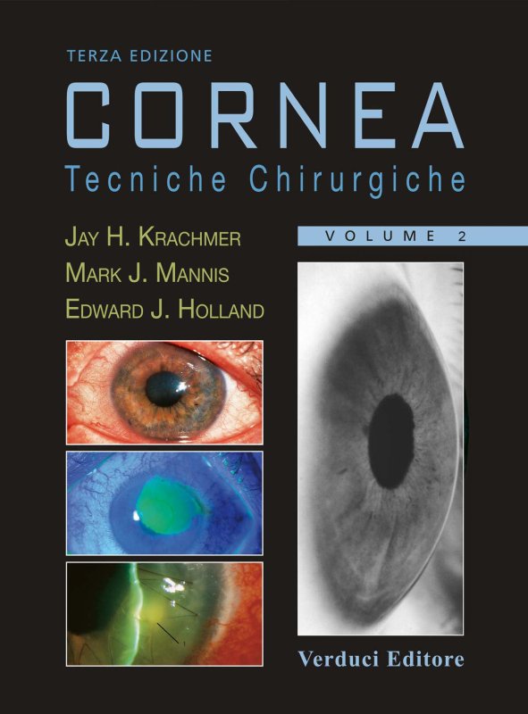 Cornea. Tecniche chirurgiche - Vol.2