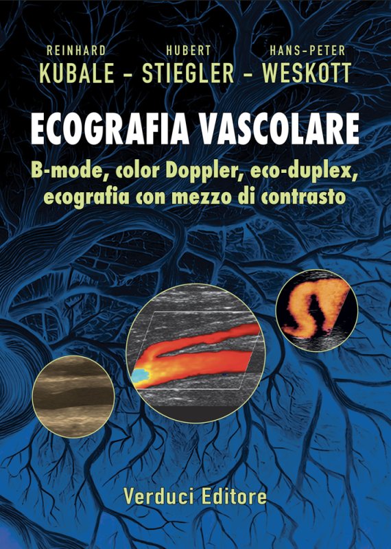 Ecografia vascolare