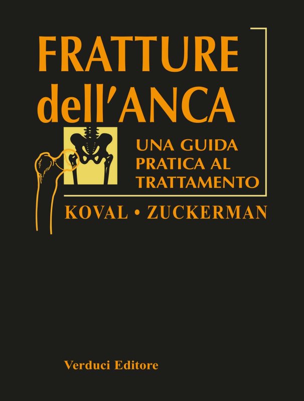Fratture dell'anca. Guida pratica al trattamento