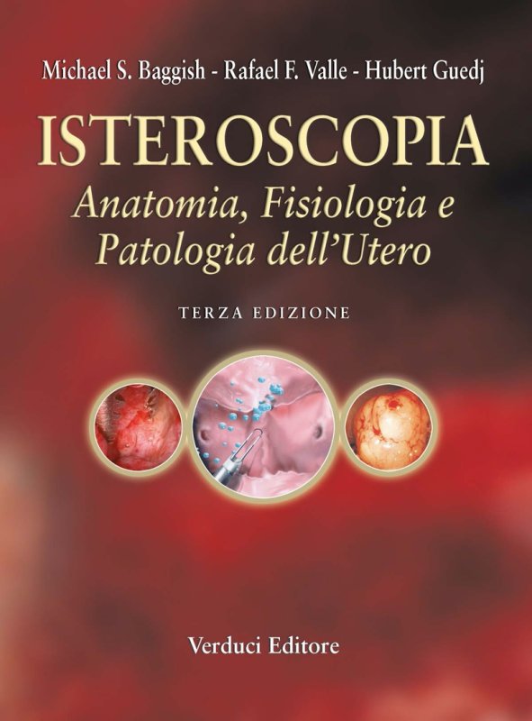 Isteroscopia. Anatomia, fisiologia e patologia dell'utero