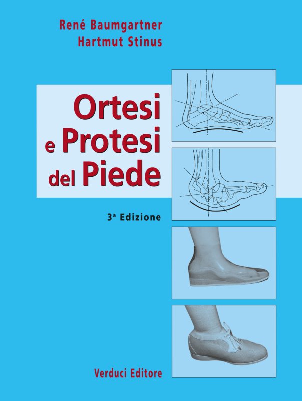 Ortesi e protesi del piede