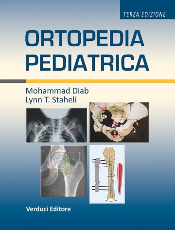 Ortopedia pediatrica