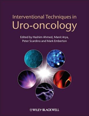 Interventional Techniques in Uro-Oncology
