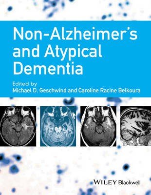 Non-Alzheimer's Dementia