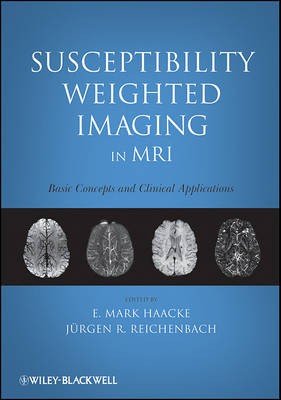 Susceptibility Weighted Imaging in MRI