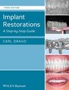 IMPLANT RESTORATIONS