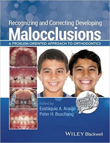 Recognizing and correcting developing malocclusions