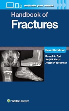 Handbook of Fractures: Print + eBook with Multimedia