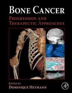 Bone Cancer