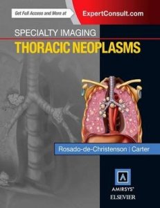 Specialty Imaging: Thoracic Neoplasms