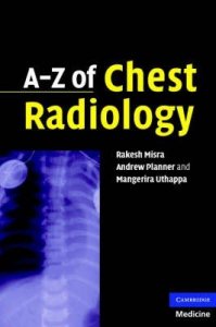 A-Z of Chest Radiology