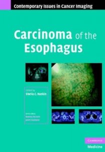Carcinoma of the Esophagus
