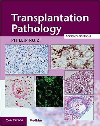 Transplantation Pathology with Online Resource