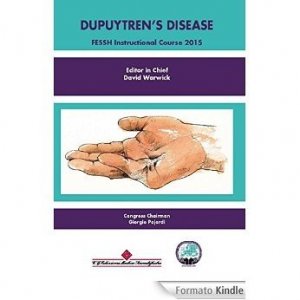 Dupuytren's disease