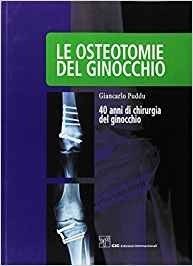Le osteotomie del ginocchio
