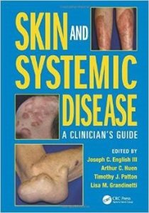 Skin and Systemic Disease